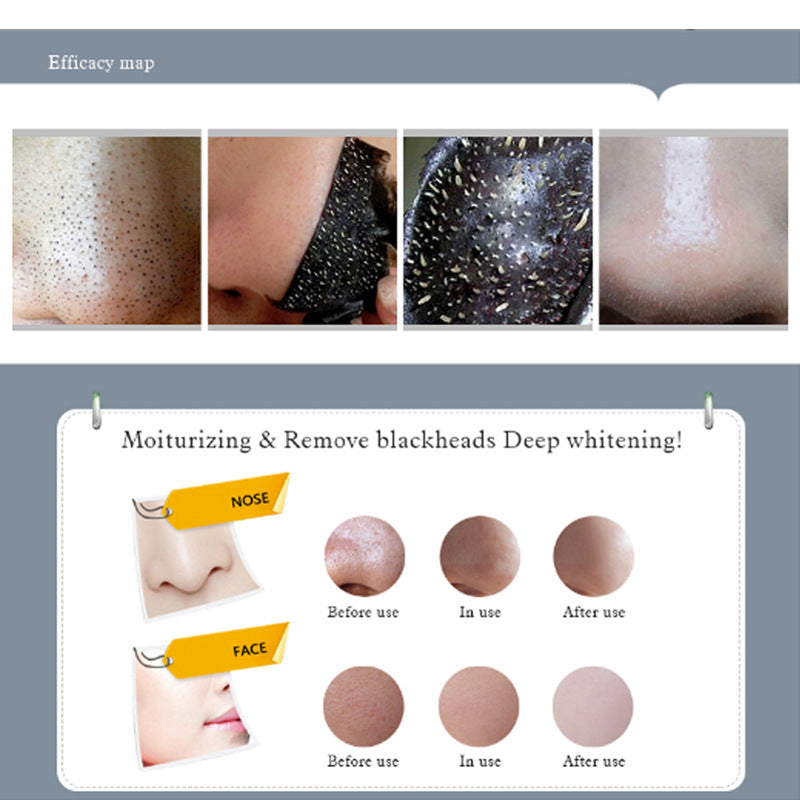 bestseller: gold peel-off mask - blackhead removal, oil control, deep cleansing, acne treatment, and skin firming