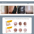 bestseller: gold peel-off mask - blackhead removal, oil control, deep cleansing, acne treatment, and skin firming