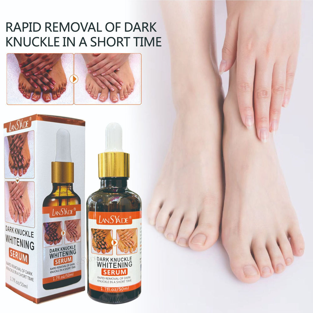 hand & finger joint brightening serum 50ml - knee & ankle dark spot corrector - melanin reducing essence
