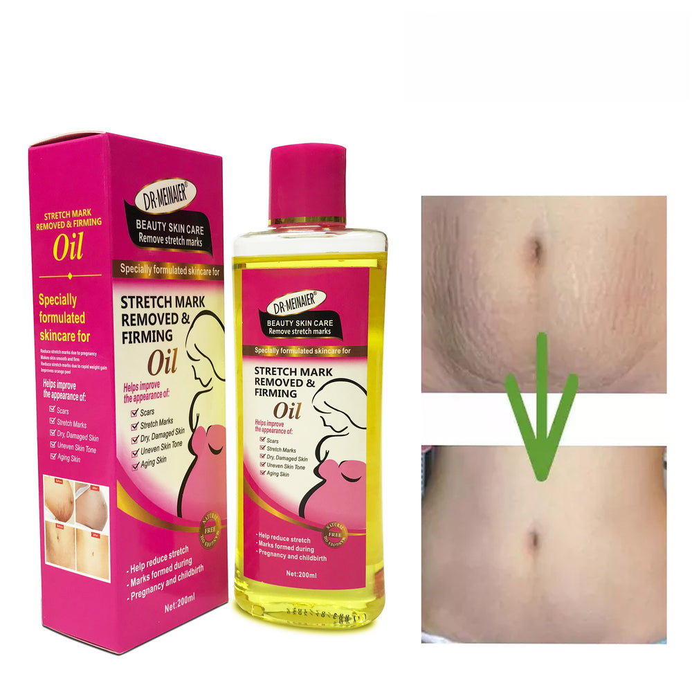 stretch mark essential oil multi-effect moisturizing pregnant oil to reduce fine lines and melanin whole body bb massage oil 200ml