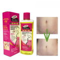 stretch mark essential oil multi-effect moisturizing pregnant oil to reduce fine lines and melanin whole body bb massage oil 200ml