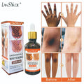 hand & finger joint brightening serum 50ml - knee & ankle dark spot corrector - melanin reducing essence
