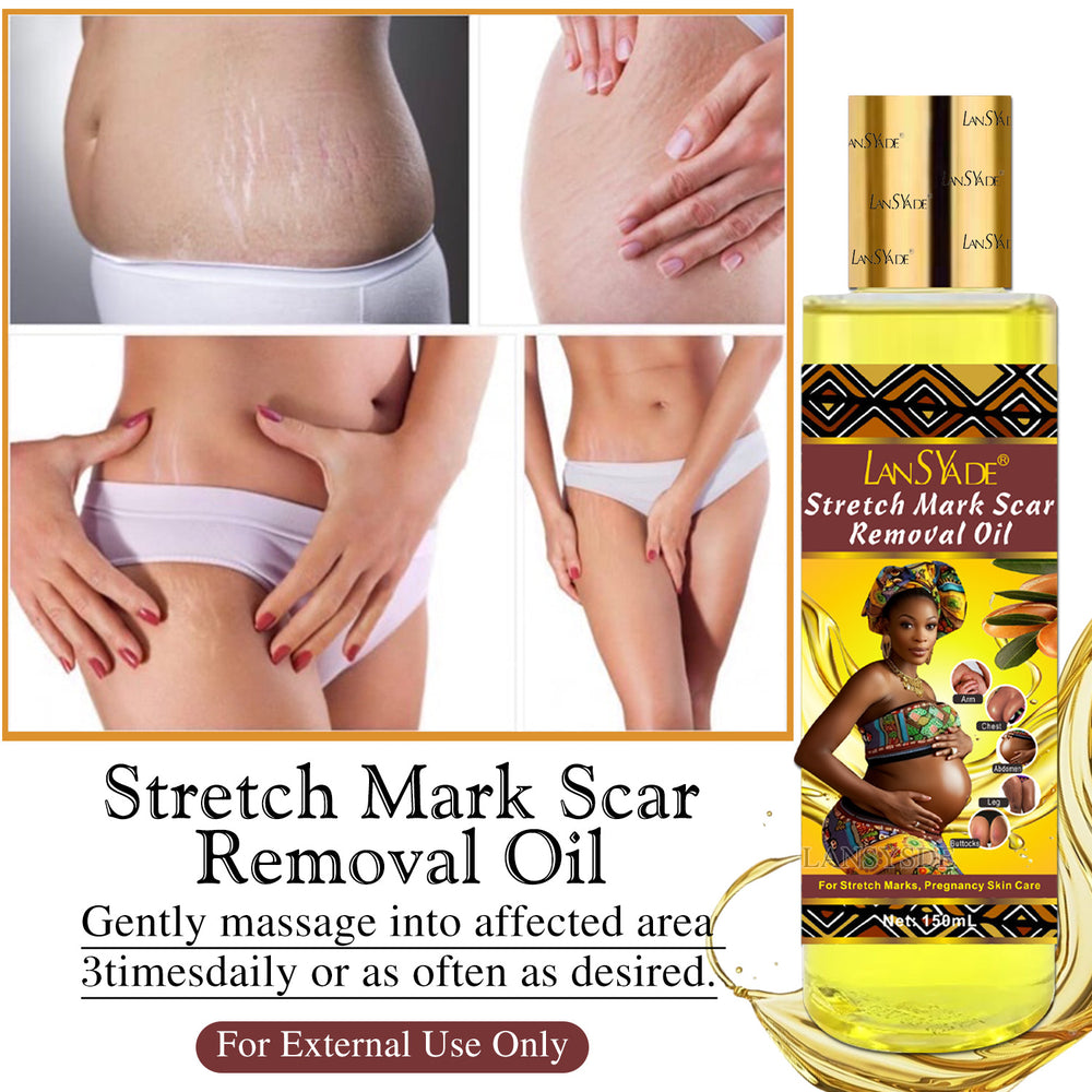 stretch mark oil lightening melanin pregnant oil moisturizing light lines repair essential oil 150ml