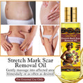 stretch mark oil lightening melanin pregnant oil moisturizing light lines repair essential oil 150ml