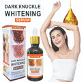 hand & finger joint brightening serum 50ml - knee & ankle dark spot corrector - melanin reducing essence