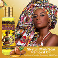 stretch mark oil lightening melanin pregnant oil moisturizing light lines repair essential oil 150ml