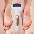Electric foot file - exfoliating callus remover, washable, rechargeable, cross-border, heel scraper, foot scrubber, foot stone