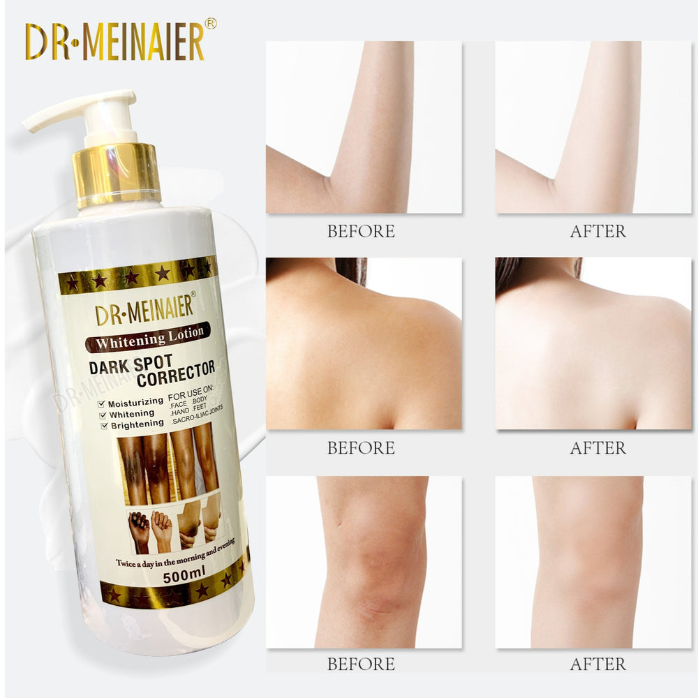 joint dark spot correcting body lotion, moisturizing & brightening, 500ml. nourishing massage cream. factory wholesale