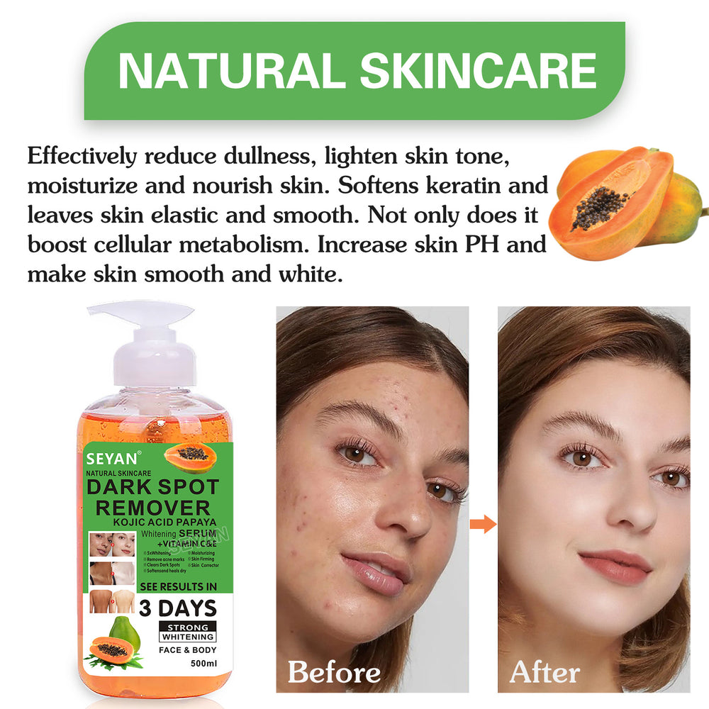 papaya vc original solution gently tightens and moisturizes the skin, facial and body hydrating moisturizing essence, brightening and toning