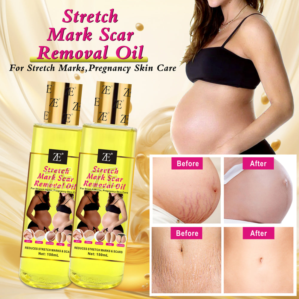 body oil stretch mark oil pregnant women repair firming moisturizing pregnant women lightening fine lines massage essential oil 150m