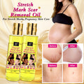 body oil stretch mark oil pregnant women repair firming moisturizing pregnant women lightening fine lines massage essential oil 150m