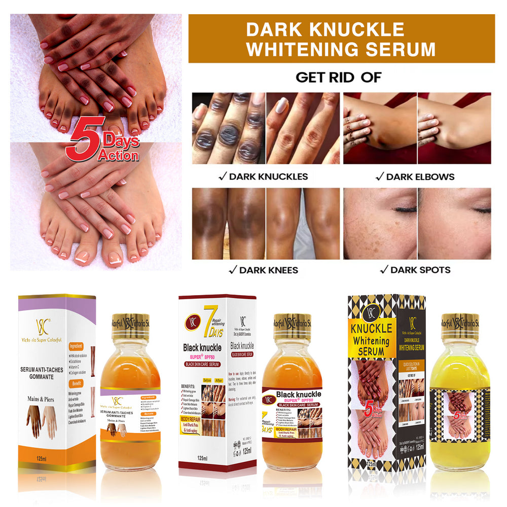 vsc 7-day turmeric essence arbutin whitening & repair serum kojic acid brightening & hydrating stock solution 125ml