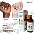 whitening hand essence - dark spot corrector, brightening, and moisturizing serum - african bestseller, wholesale for export, 50ml