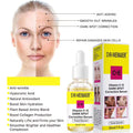 vcve vitamin c brightening skin facial hand foot essence dark spot serum brightening serum