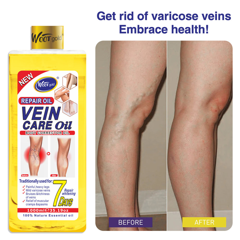 foreign trade wootgold vein dilating essential oil earthworm leg soothing pulse soothing leg massage massage oil 1000