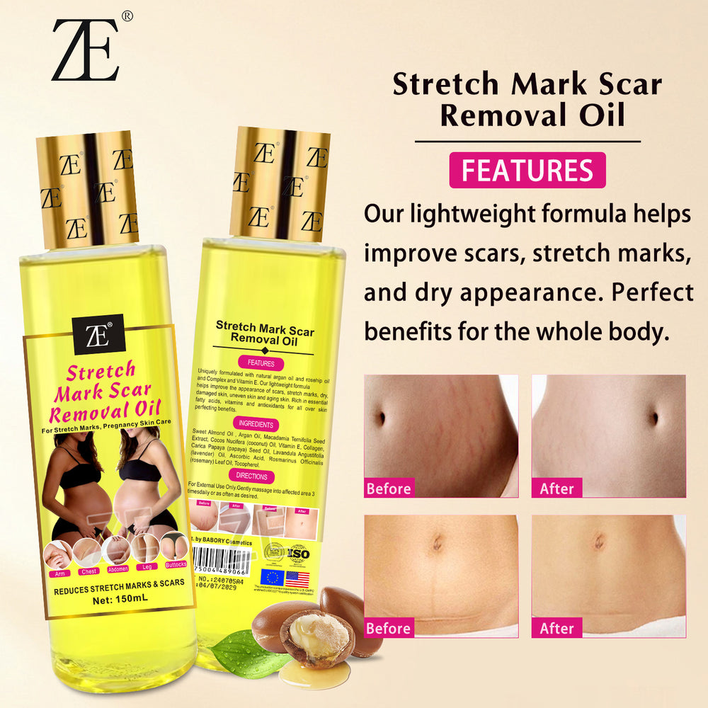 body oil stretch mark oil pregnant women repair firming moisturizing pregnant women lightening fine lines massage essential oil 150m