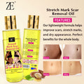 body oil stretch mark oil pregnant women repair firming moisturizing pregnant women lightening fine lines massage essential oil 150m