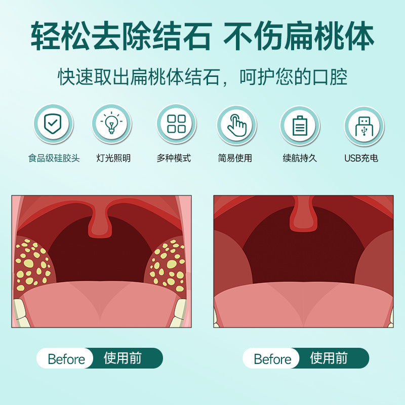 new electric tonsil stone remover oral cleaning tonsil stone removal care tool