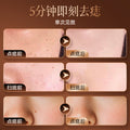 russian hot-selling electric mole spot pen, small white spot removal, laser spot removal, metal body beauty pen