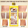 foreign trade vsc varicose veins oil calf convex veins essential oil heating massage leg soothing massage oil