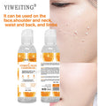 exfoliating gel vitamin c exfoliating gel facial body cleansing rejuvenating moisturizing fresh orange