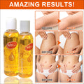 stretch mark oil - melanin reducing, dark spot correcting, multivitamin massage oil 100ml - repair oil for export