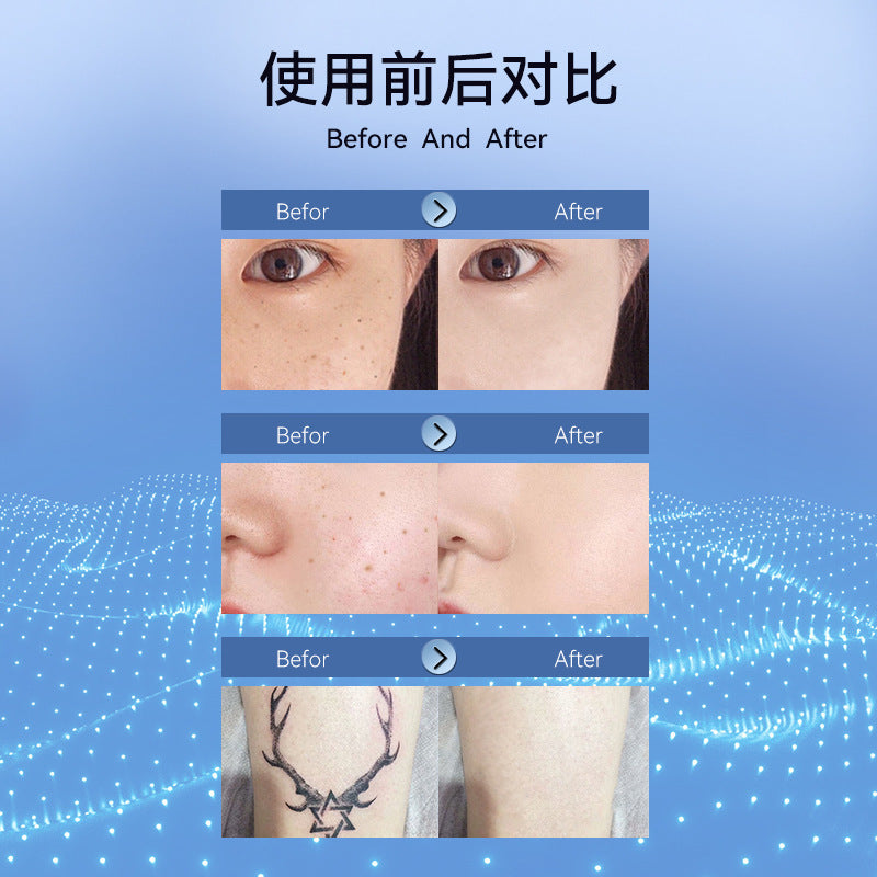 hot-selling electric mole spot pen, small white spot removal, laser spot removal, metal body beauty pen, source product