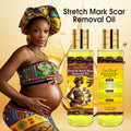 stretch mark oil lightening melanin pregnant oil moisturizing light lines repair essential oil 150ml