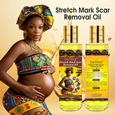 stretch mark oil lightening melanin pregnant oil moisturizing light lines repair essential oil 150ml