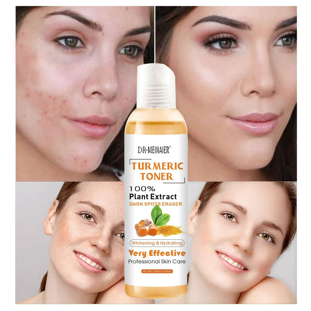 turmeric toner - hydrating, moisturizing, firming, and soothing skin essence water 118ml - wholesale for export