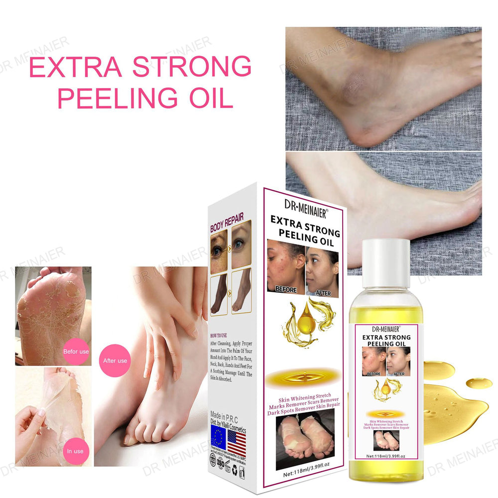 Peeling oil cross-border peeling oil whitening exfoliation lightening spots bright skin hand facial body care